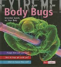 Body Bugs!: The Uninvited Guests on Your Body (Extreme!)