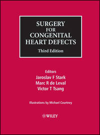 Surgery for Congenital Heart Defects by Marc R. de Leval