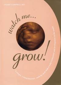 Watch Me Grow: A Unique, 3-Dimensional Week-by-Week Look at Your Baby's Behavior and Development...