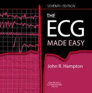 The Ecg Made Easy