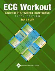ECG Workout Exercises in Arrhythmia Interpretation by Jane Huff