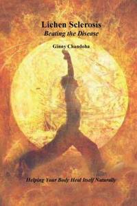 Lichen Sclerosis: Beating the Disease