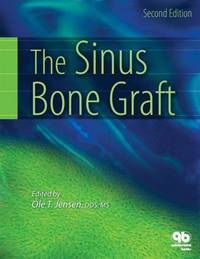 THE SINUS BONE GRAFT 2ED (HB 2006)