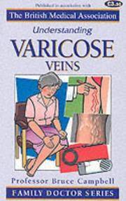 Understanding Varicose Veins (Family Doctor Series) by Campbell, Bruce - 09/01/2000