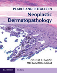 Pearls and Pitfalls in Neoplastic Dermatopathology with Online Access by Dadzie, Ophelia E. [Editor]; Mahalingam, Meera [Editor] - 2016