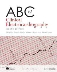 Abc Of Clinical Electrocardiography