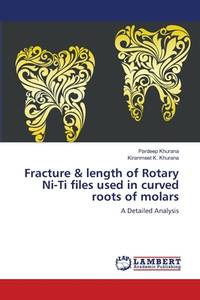 Fracture & length of Rotary Ni-Ti files used in curved roots of molars: A Detailed Analysis
