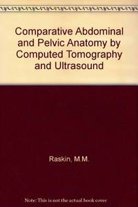 COMPARATIVE ABDOMINAL AND PELVIC ANATOMY BY COMPUTED TOMOGRAPHY AND ULTRAS