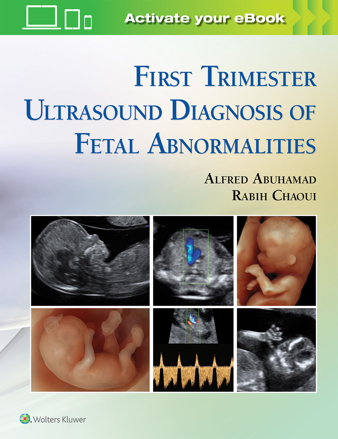 First Trimester Ultrasound Diagnosis of Fetal Abnormalities by Abuhamad MD, Alfred Z First Trimester Ultrasound Diagnosis of Fetal Abnormalities by Abuhamad MD, Alfred Z