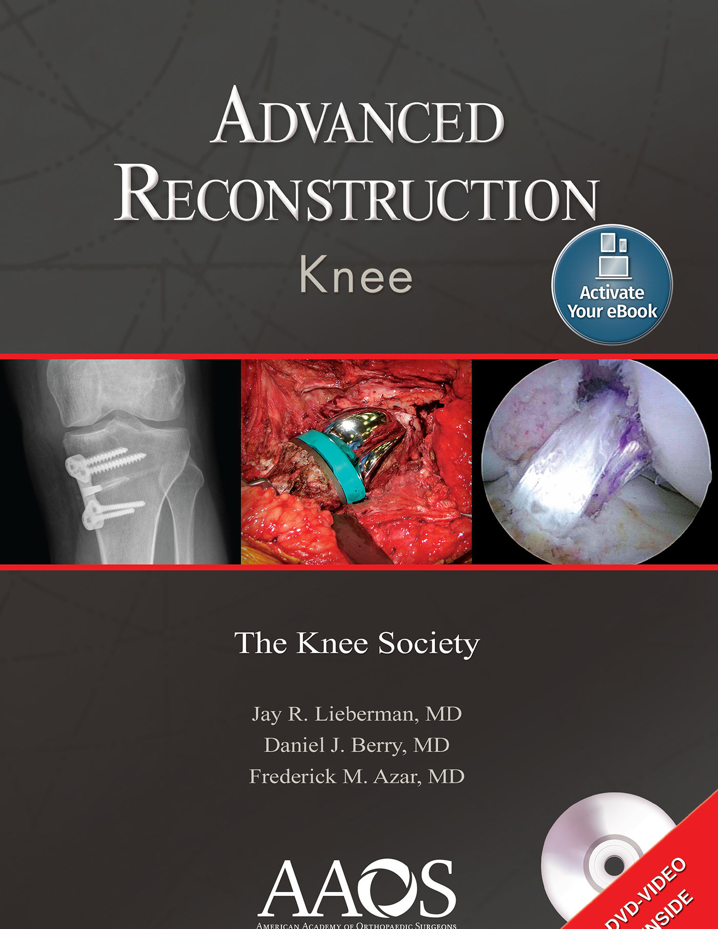 Advanced Reconstruction Knee The Knee Society Hb 11 By Lieberman J R 11 From Vikram Jain Books Sku Cbs