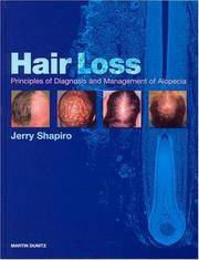 Hair Loss: Principles of Diagnosis and Management of Alopecia