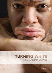 image of Turning White: A Memoir of Change