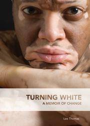 Turning White