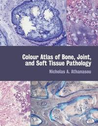 Colour Atlas of Bone, Joint, and Soft Tissue Pathology by Nicholas A ...