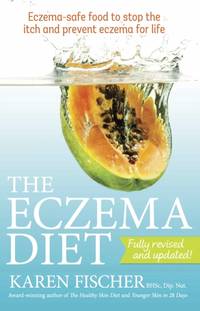 Eczema Diet : Eczema-safe food to stop the itch and prevent eczema for life