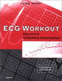 ECG Workout : Exercises in Arrhythmia Interpretation