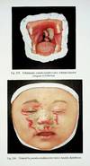 Jacobi's Atlas of Dermochromes with English text