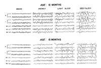 Atlas of Electroencephalography in the Developing Monkey, Macaca Mulatta