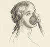 On the Inhalation of the Vapour of Ether in Surgical Operations: containing a Description of the Various Stages of Etherization and a Statement of the Result of nearly Eighty Operations in which Ether has been employed in St. George's and University College Hospitals