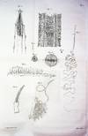 Anatomie des Vers Intestinaux, Ascaride Lombricoide, et Echinorhynque Geant
