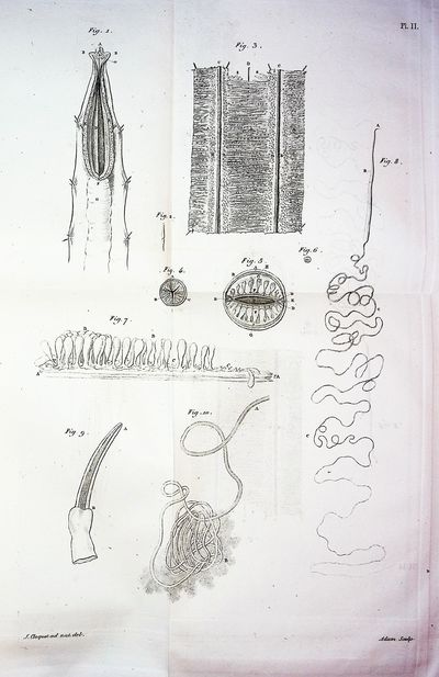 Anatomie des Vers Intestinaux, Ascaride Lombricoide, et Echinorhynque Geant