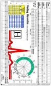 ECG Ruler standard