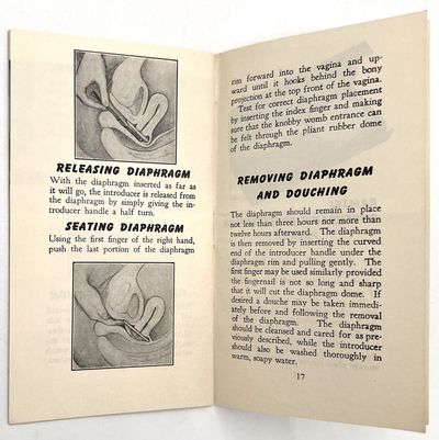 The Ramses Method of Contraception; (photo 5)