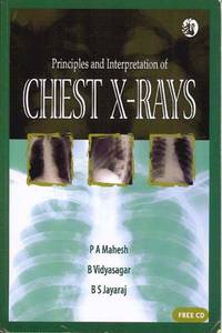 Principles and Interpretation of Chest X-rays by B S Jayaraj