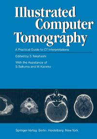 Illustrated Computer Tomography