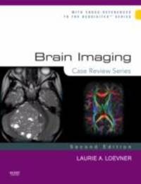Brain Imaging