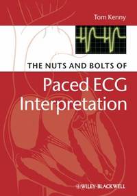 Paced ECG Interpretation