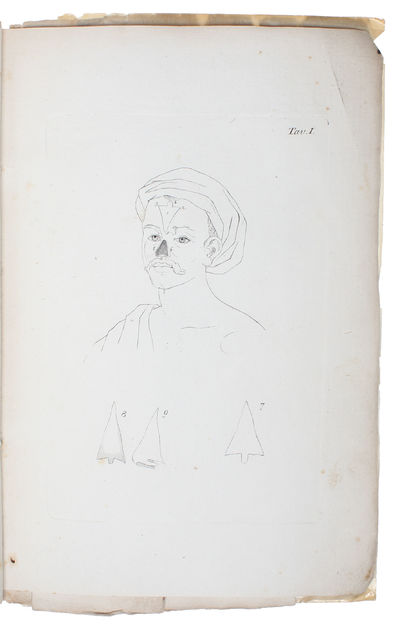 Degli innesti animali. - [THE BEGINNING OF A NEW ERA FOR PLASTIC SURGERY] (photo 3)