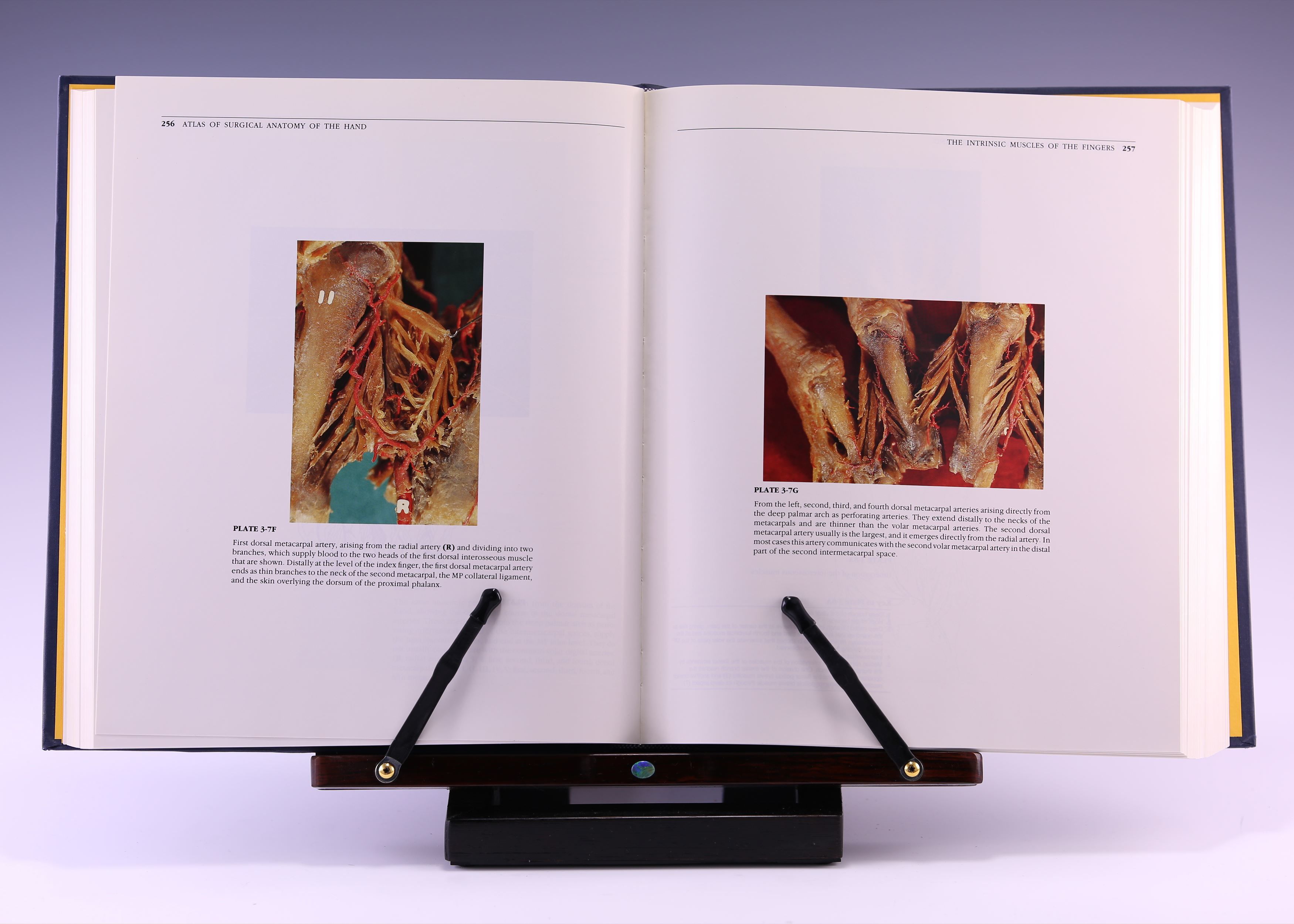 Atlas of Surgical Anatomy of the Hand by Eduardo A. Zancolli