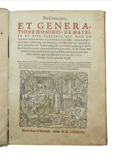 De conceptu et generatione hominis