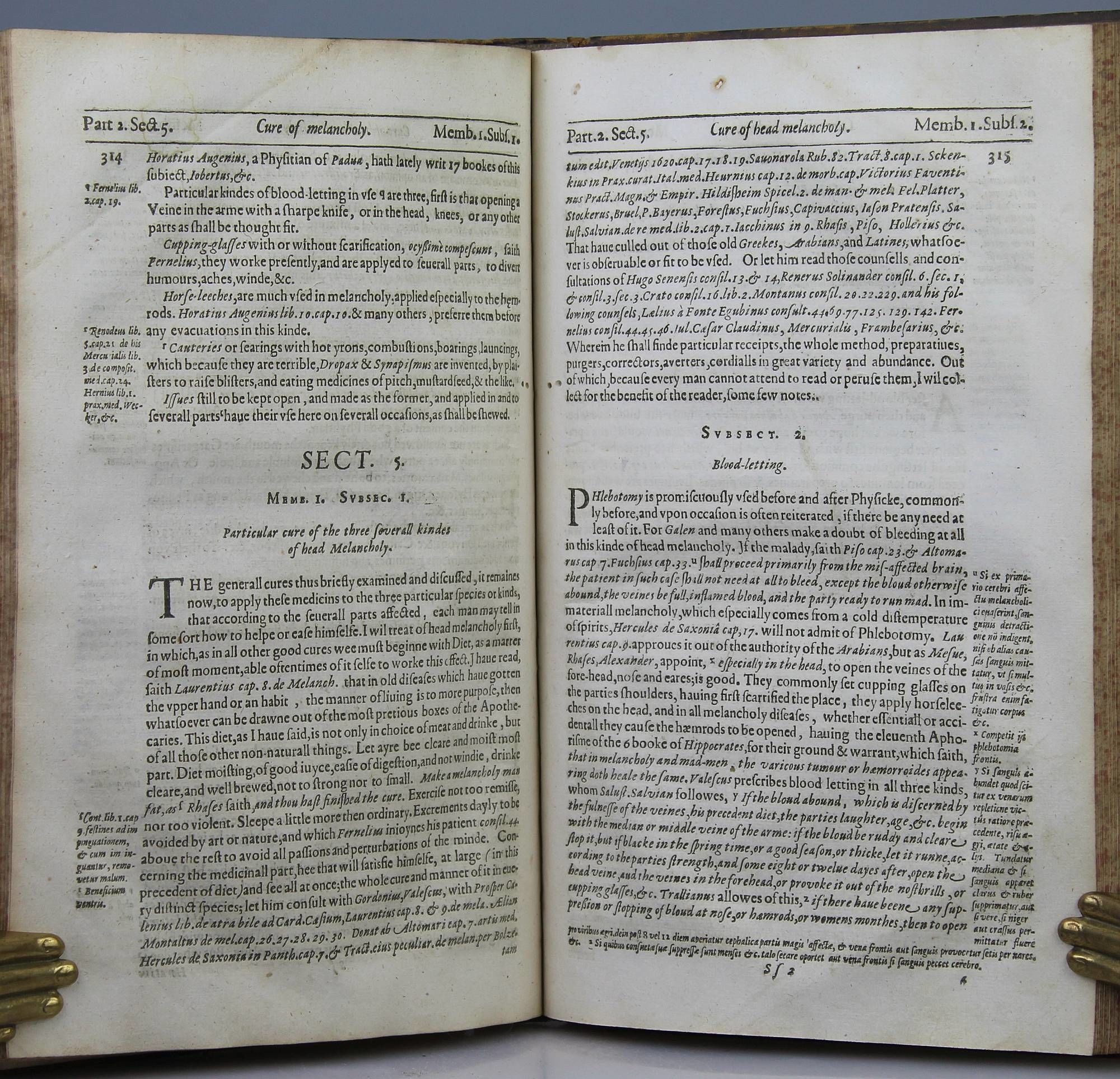 The Anatomy of Melancholy What It Is. With All Kindes, Causes