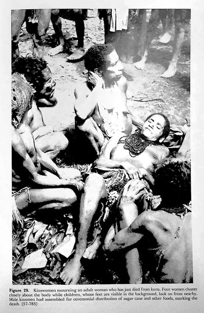 SIGNED. Kuru. Early Letters and Field-Notes from the Collection of D. Carleton Gajdusek