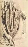 [HUMAN ANATOMY]. Ontleding des menschelyken lichaams..