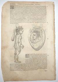 16th-century leaf with four illustrations of conjoined twins and birth defects from Ambroise ParÃ©&#039;s Monsters by Ambroise ParÃ© - 1585