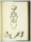 MUSEUM ANATOMICUM ACADAMIAE LUGDUNO-BATAVAE