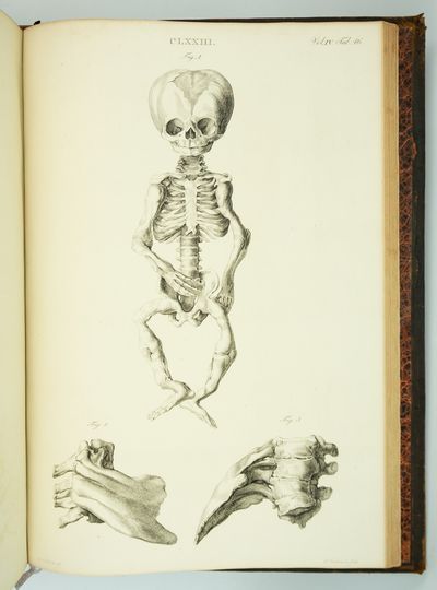 MUSEUM ANATOMICUM ACADAMIAE LUGDUNO-BATAVAE