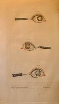 A Treatise on Some Practical Points Relating to the Diseases of the Eye, by the Late John Cunnington Saunders, Demonstrator of Anatomy at St. Thomas's Hospital, Founder and Surgeon of the London Infirmary for Curing Diseases of the Eye (The Horblit Copy)