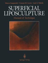 Superficial Liposculpture : Manual of Technique