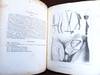 View Image 4 of 5 for NEW ELEMENTS OF OPERATIVE SURGERY... Inventory #015833