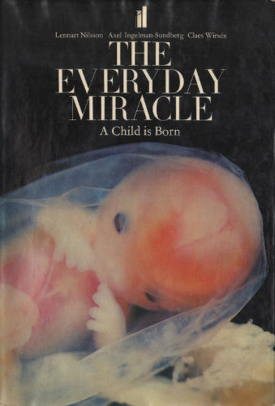 THE EVERYDAY MIRACLE. A Child is Born.