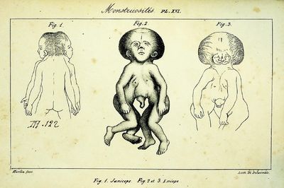 1836 Histoire Generale et Particuliere des Anomalies de l'Organisation Chez l'Homme et les Animaux:  [General and Particular History of Organizational Anomalies in Man and Animals]