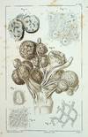 Physiologie Pathologique ou Recherces Cliniques, Experimentales et Microscopiques, sur l'Inflammation, la Tuberculasation, les Tumerus, la Formation du Cal, Etc. [Pathologic Physiology or Clinical Research, Experimental and Microscopic, on Inflammation, Tuberculosis, Tumors, Formation of Calcification, Etc.]