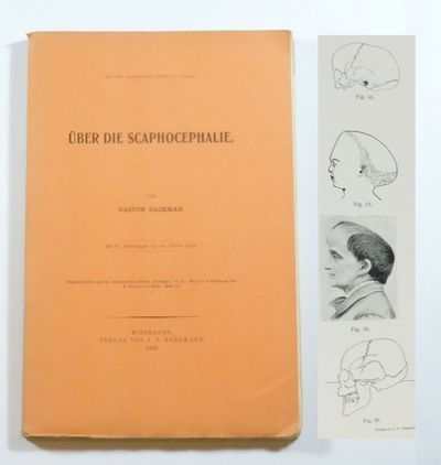 Über die Scaphocephalie. Mit 61 Abbildungen auf…