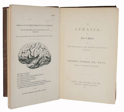 On Aphasia, or Loss of Speech, and The…