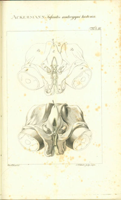 Infantis androgyni historia et ichnographia