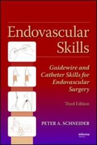 Endovascular Skills : Guidewire and Catheter Skills for Endovascular Surgery